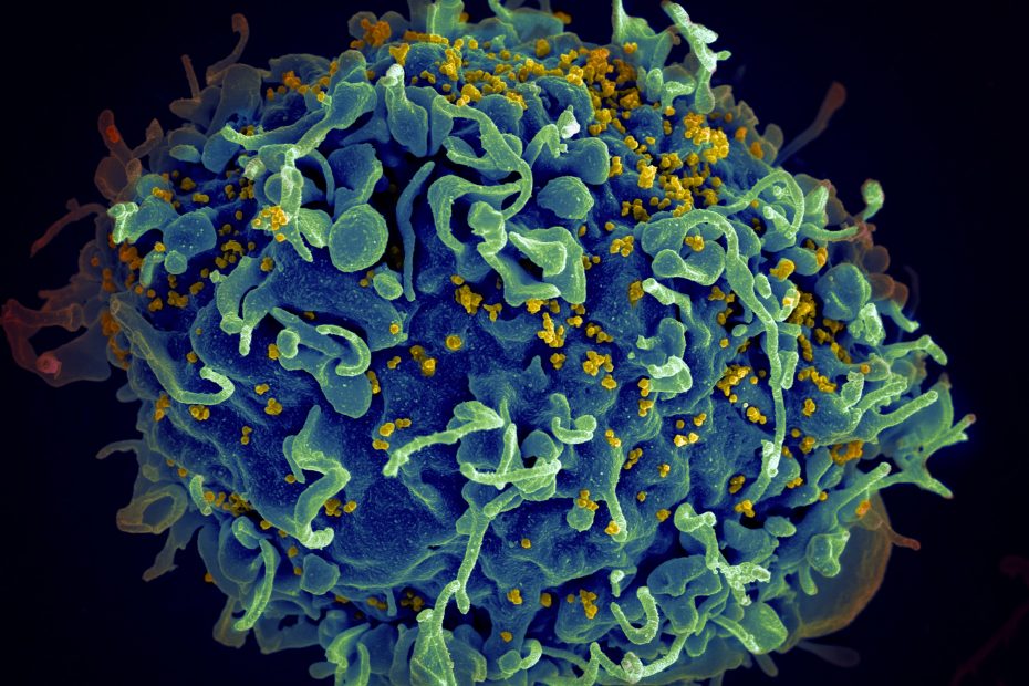 HIV, the AIDS virus (yellow), infecting a human cell, @Unsplash